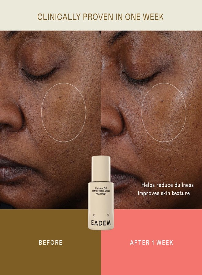 EADEM Gentle Exfoliating AHA & PHA Toner, Exfoliating Face Serum with Tranexamic Acid, AHA Exfoliant & Pore Minimizer for Face and Body, Acne Spot Serum, 5.0 oz, Cashmere Peel - Image 4